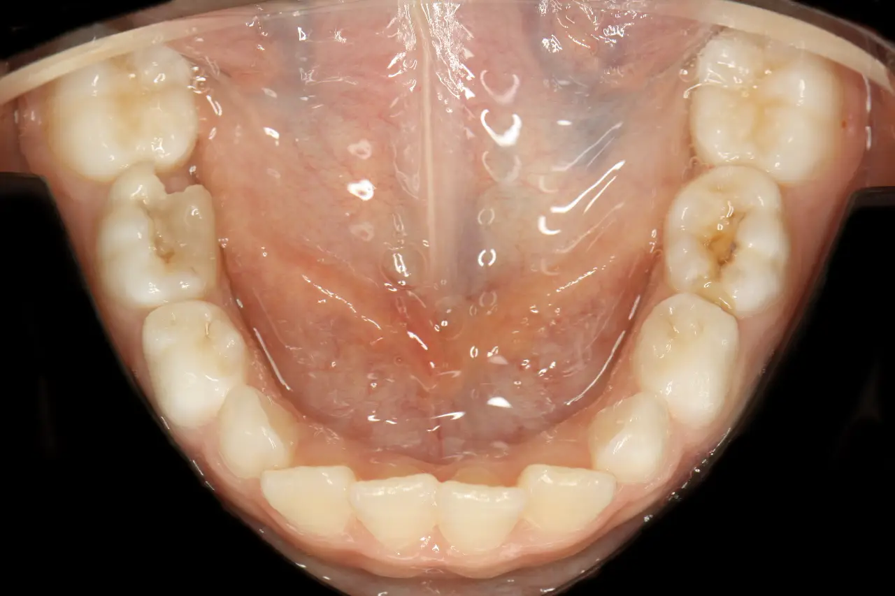 Documentação ortodôntica completa com radiografias, modelos e fotografias intra e extra orais