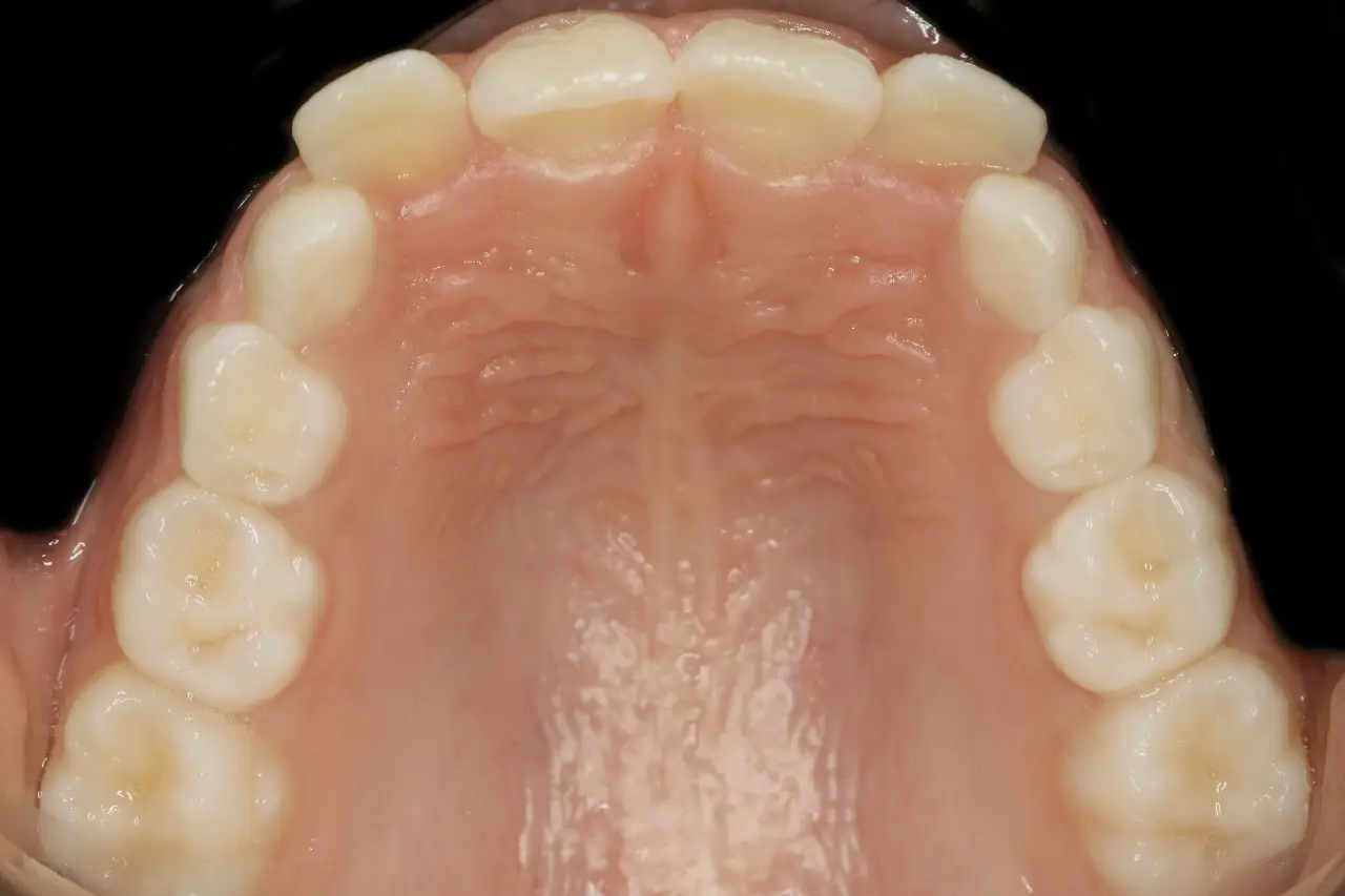 Documentação ortodôntica completa com radiografias, modelos e fotografias intra e extra orais