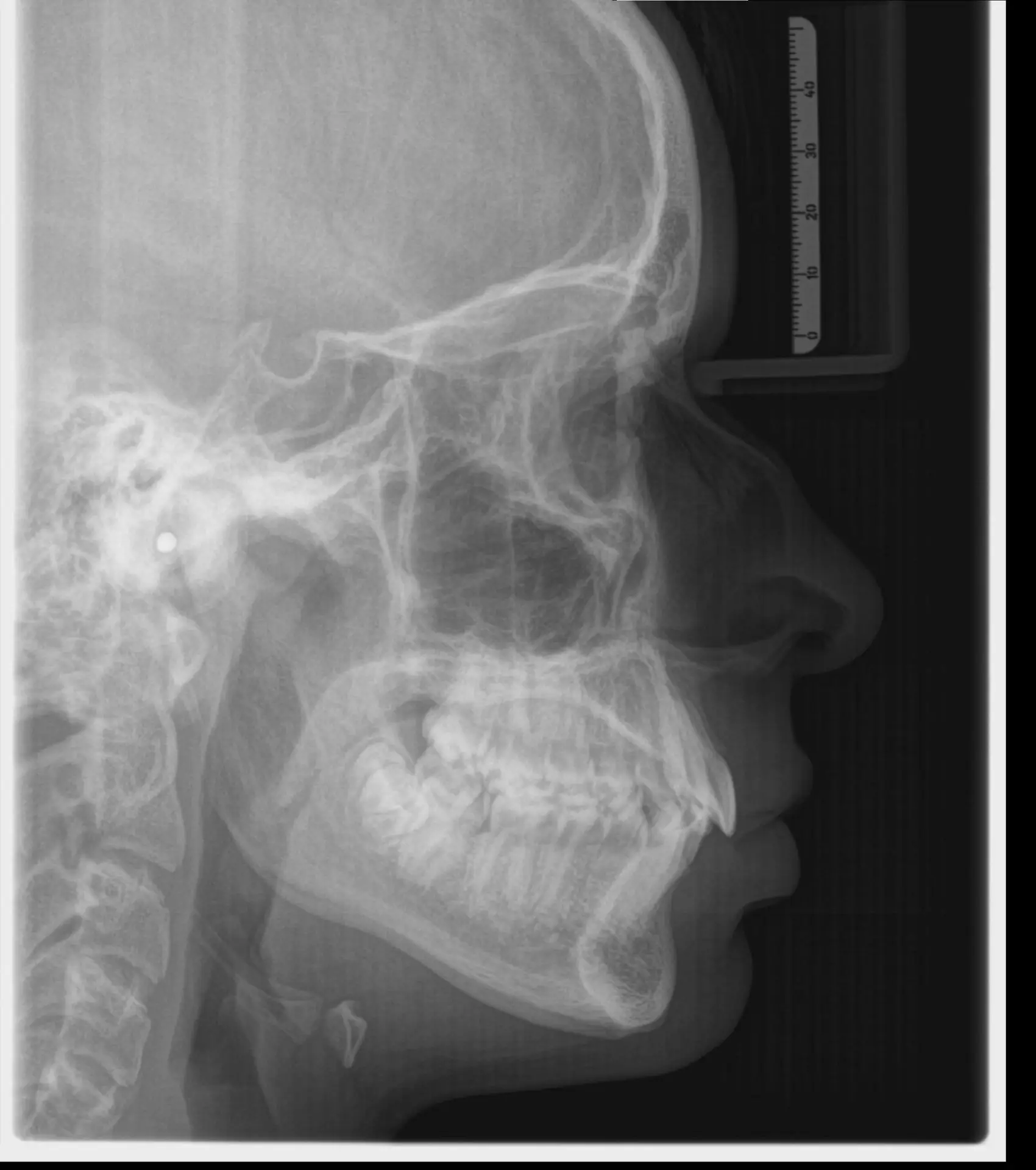 Telerradiografia